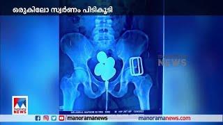 കരിപ്പൂര്‍ വിമാനത്താവളത്തില്‍ പൊലീസ് ഒരു കിലോ സ്വര്‍ണം പിടികൂടി| Karipur | Gold