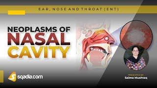 ENT Lecture | Neoplasms of Nasal Cavity | Medical Student V-Learning