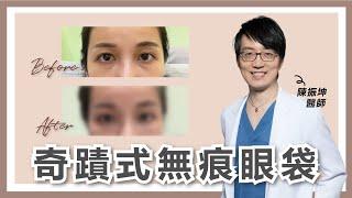 【眼袋手術案例】改造眼袋，給你桃花電眼by陳振坤整形外科醫師