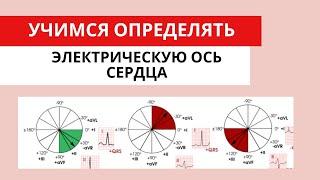 Легкий способ определить ЭОС (электрическую ось сердца)