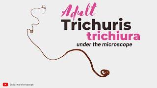 Adult Trichuris trichiura under the microscope