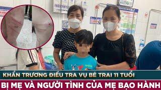 Khẩn trương điều tra vụ bé trai 11 tuổi bị mẹ và người tình của mẹ bạo hành