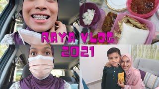 raya vlog + tightening braces 2021 | fatini rahim