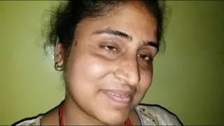 TREATMENT OF RETINITIS PIGMENTOSA CURED DR RISHABH JAIN +919425092329