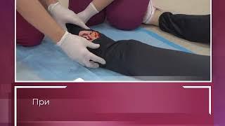 Первая помощь "Травмы конечности"
