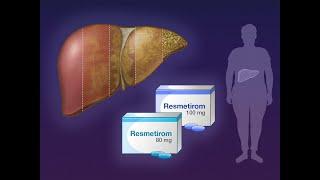 Resmetirom for NASH with Liver Fibrosis | NEJM