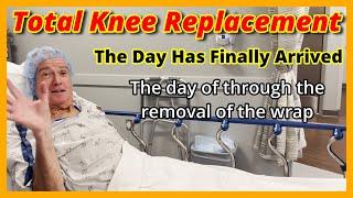 My Knee Replacement Surgery:  Follow along on my day of surgery and the unwrapping the next day #8