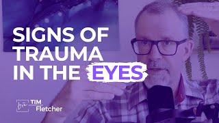 What Your Eyes Tell You About Trauma