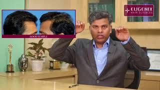 Best Hair Transplant Surgeon in Mumbai | India - Dr Pradeep Sethi @EugenixHairSciencesofficial