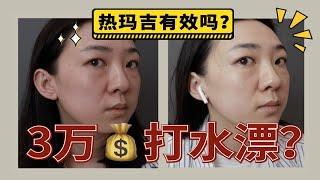 热玛吉骗局！不疼没效果？3个月前后对比！看过100+攻略，没想到还是踩坑了！热玛吉抗衰3条避坑建议，缴费前看清哦！