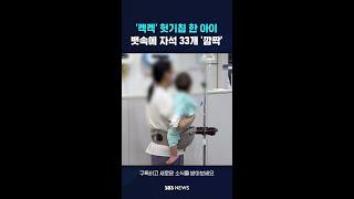 '켁켁' 헛기침 한 아이…뱃속에 자석 33개 '깜짝' #shorts