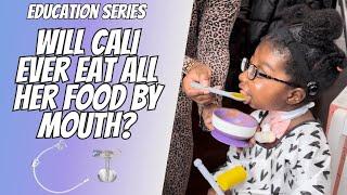 WILL CALI EVER EAT ALL HER FOOD BY MOUTH #GTUBE #ngtube