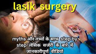 Lasik surgery| लेसिक  सर्जरी