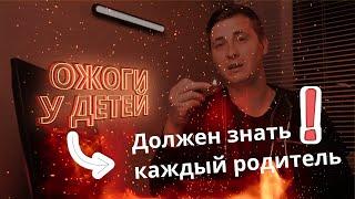 ОЖОГ у ребенка | Первая ПОМОЩЬ при ожоге у малыша | Как УБЕРЕЧЬ ребенка от ОЖОГОВ