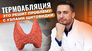 ТЕРМОАБЛЯЦИЯ – решение для УЗЛОВ щитовидной железы