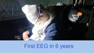 Elin has an EEG for the first time in 6 years