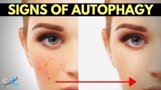 Signs of Autophagy - How to Know If You're In Autophagy