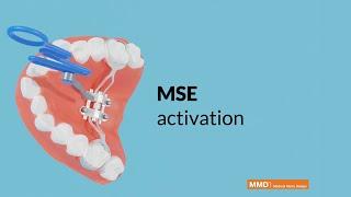 Palatal Expander MSE, Maxillary Skeletal Expander, activation