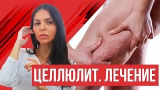 Целлюлит. Профилактика и лечение