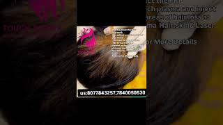 PRP Treatment for Hair PRP platelet-rich plasma and at Touch Derma Clinic.us:8077843257,7840050530