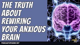 The Truth About Rewiring An Anxious Brain | Podcast Episode 307