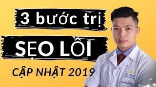 Điều trị SẸO LỒI cập nhật 2019, công thức được tiết lộ từ GS, Bác sỹ Bệnh Viện 108