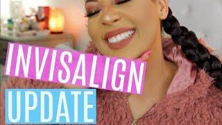 10 Months Of Invisalign | My Final Update