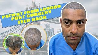 Best Hair Transplant in London | Best Hair Transplant Result & Cost in United Kingdom