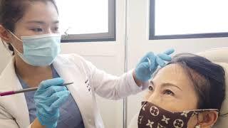 年轻不再是梦！Botox(肉毒素除皱)_深度体验