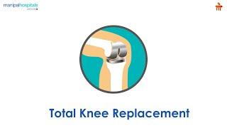 What is Total Knee Replacement? l Manipal Hospitals Bengaluru