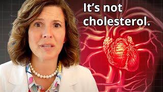 It's not about cholesterol.