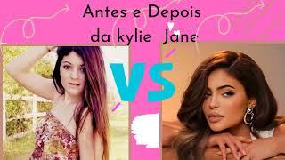 olha esse antes e Depois da Kylie jenne antes #e #depois #da  #famosos #antesedepois #brasil