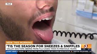 Arizona doctor gives tips to stay healthy during flu season