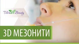 3D МЕЗОНИТИ (3D лифтинг и 3D армирование) в клинике Telo’s Beauty