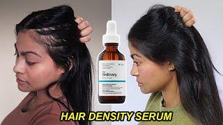 I tried The Ordinary Hair Density Serum for 1 YEAR & THIS HAPPENED! | Before and after results