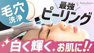 【マッサージピール】最強の美白治療！毛穴汚れを除去してコラーゲンを増やします【ストロボフフェイシャル】