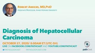 Diagnosis of hepatocellular carcinoma - Dr. Anders (Hopkins) #LIVERPATH