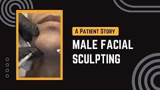 A Patient Story | Male Facial Sculpting | West Hollywood, CA | Dr. Jason Emer