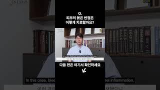 피부의 붉은 반점은 어떻게 치료할까요? #자반증