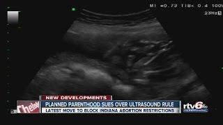 Planned Parenthood sues over ultrasound rule