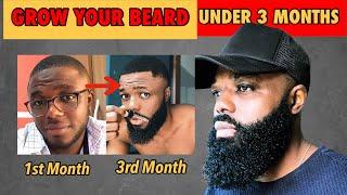 How To Grow A Full Beard In Less Than 3 Months In 2024(FULL GUIDES)