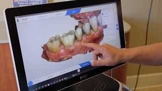 Ease of Use - CEREC Primescan