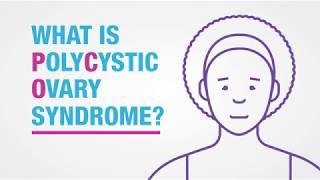 Polycystic Ovary Syndrome (PCOS) Symptoms
