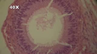 MICROSCOPIC VIEW - EPIDIDYMIS