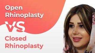 Open vs. Closed Rhinoplasty Explained: Differences, Pros & Cons
