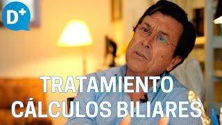 Tratamiento de los cálculos biliares