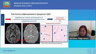 ВЕБИНАР «НЕЙРОРАДИОЛОГИЯ В ПЕДИАТРИЧЕСКОЙ ПРАКТИКЕ»