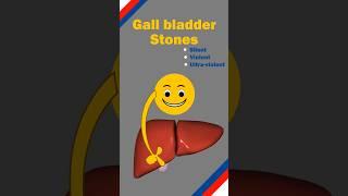 Gall Bladder Stones - Silent, Violent, Ultra- Violent #gallbladderstones  #drtulip