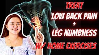 Treating Lumbar Spondylosis with Home Exercises | Doc Cherry