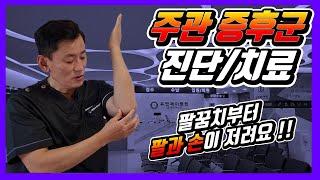 #주관증후군 #척골신경포착증후군 #손저림증